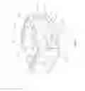 Fig. 02 - Stand alone interbody spinal system