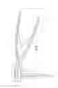 Fig. 09 - Tool and method for separating a femoral cup from an acetabular ball in an implanted hip prosthesis