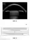 Fig. 07 - Methods and systems for performing a posterior capsulotomy and for laser eye surgery with a penetrated cornea