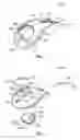 Fig. 02 - Intraocular drainage device