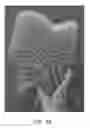 Fig. 71 - Negative pressure wound closure device