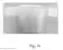 Fig. 33 - Configurable absorbent articles
