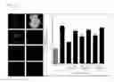 Fig. 07 - Cosmetic composition comprising white rose flower extract for skin whitening and improving skin wrinkle