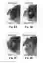 Fig. 02 - Compositions and Methods for Treating Alzheimer's Disease and Other Tauopathies