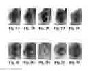 Fig. 05 - Compositions and Methods for Treating Alzheimer's Disease and Other Tauopathies