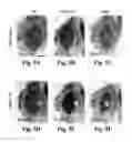 Fig. 10 - Compositions and Methods for Treating Alzheimer's Disease and Other Tauopathies