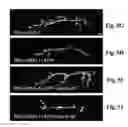 Fig. 11 - Compositions and Methods for Treating Alzheimer's Disease and Other Tauopathies