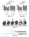 Fig. 15 - Compositions and Methods for Treating Alzheimer's Disease and Other Tauopathies