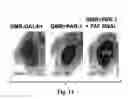 Fig. 19 - Compositions and Methods for Treating Alzheimer's Disease and Other Tauopathies