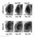 Fig. 23 - Compositions and Methods for Treating Alzheimer's Disease and Other Tauopathies