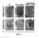 Fig. 25 - Compositions and Methods for Treating Alzheimer's Disease and Other Tauopathies