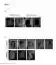Fig. 02 - SOMATIC STEM CELLS FOR TREATING BONE DEFECTS