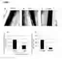 Fig. 08 - A METHOD OF TREATING OR PREVENTING SEPSIS