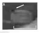 Fig. 01 - Risperidone biodegradable implant