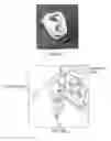 Fig. 03 - Closed loop system for direct harvest and transfer for high volume fat grafting