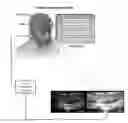 Fig. 01 - MELANOPSIN STIMULATION USING NEURALLY PRIMED CONTENT