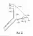 Fig. 49 - Percutaneous ureteral catheter