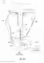 Fig. 83 - Percutaneous ureteral catheter