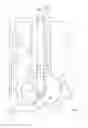 Fig. 02 - Expandable intubation assemblies