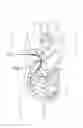 Fig. 02 - DRAINAGE CATHETER WITH BALLOON
