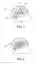 Fig. 02 - System and method for draining cerebrospinal fluid in hydrocephalus patients