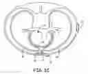 Fig. 04 - Devices and techniques for anchoring an implantable medical device