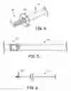 Fig. 06 - Devices and techniques for anchoring an implantable medical device
