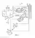 Fig. 02 - LEAD ANCHORS FOR ELECTRICAL STIMULATION LEADS AND SYSTEMS AND METHODS OF MAKING AND USING