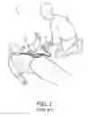 Fig. 02 - Automated external defibrillator with shortened pause for rhythm analysis