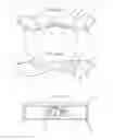 Fig. 07 - Shoulder Rehabilitation Tool