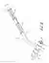 Fig. 03 - Compression roller device