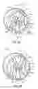 Fig. 02 - Vehicle logo-rim apparatus and a method of making same