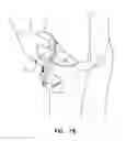 Fig. 45 - Utility assembly and coupling mechanism