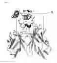 Fig. 12 - Interferon alpha and omega antibody antagonists