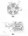 Fig. 03 - Fan drive gear system with improved misalignment capability