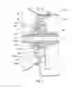 Fig. 02 - REMANUFACTURING A TRANSMISSION PUMP ASSEMBLY