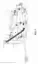 Fig. 08 - Safety Block