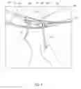 Fig. 08 - Band clamp
