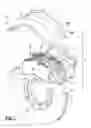 Fig. 02 - Brake carrier and method of manufacture