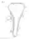 Fig. 02 - Tensioner