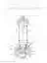 Fig. 01 - Globe valve and arrangement for a globe valve