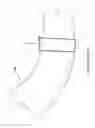 Fig. 02 - Corrugated band clamp