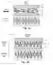 Fig. 04 - Ophthalmic device including dynamic visual field modulation