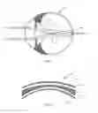 Fig. 02 - Ophthalmic lens