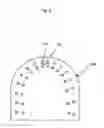 Fig. 09 - Treatment of teeth by aligners