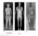 Fig. 03 - Automated target recognition based body scanner using database scans