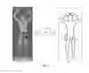 Fig. 04 - Automated target recognition based body scanner using database scans