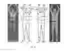 Fig. 06 - Automated target recognition based body scanner using database scans