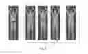Fig. 07 - Automated target recognition based body scanner using database scans