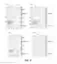 Fig. 12 - Disease recognition from images having a large field of view